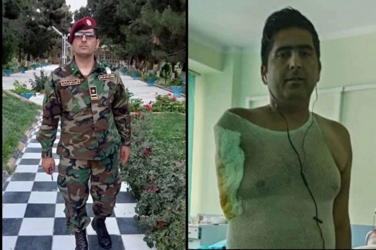 Former Afghan commando officer Jihad Mohammad Gul Nawaie in uniform (left) and in hospital (right) after being detained and tortured by Belarusian police, resulting in the amputation of his hand. (Photo Credit: Exclusive)