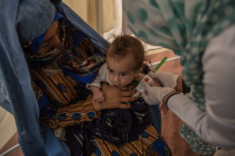 A malnourished child undergoes screening at a nutrition center in Afghanistan, where 3.7 million children under five suffer from acute malnutrition and budget shortages have forced the closure of 305 nutrition facilities. (Photo Credit: WV)