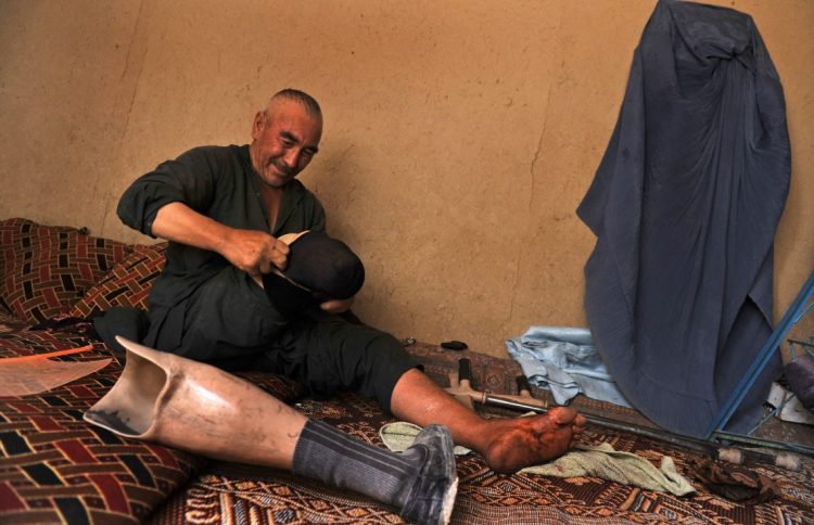 A man with a prosthetic leg sits in his home in Afghanistan, where decades of conflict have left 1.5 million people living with severe disabilities and at increased risk of hunger. (Photo Credit: AFP)