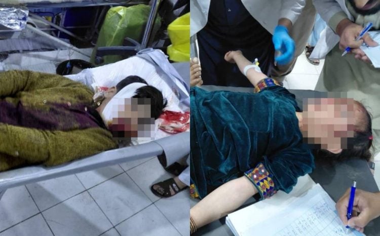 Victims of Kunar strikes, Photo Credit: X/FitratHamd