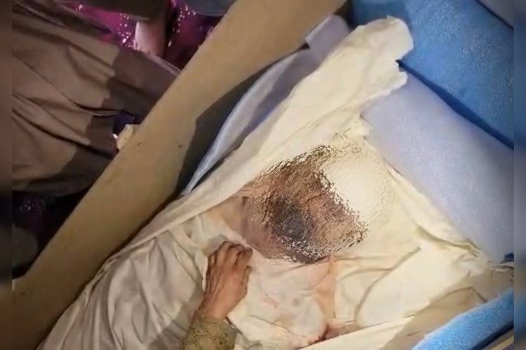 Blurred victim image. Photo Credit: Exclusive