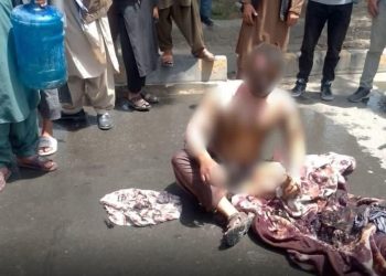 A severely burned man sits on a Kabul street after setting himself on fire amid reports of poverty and unemployment. (Photo credit: Social media)