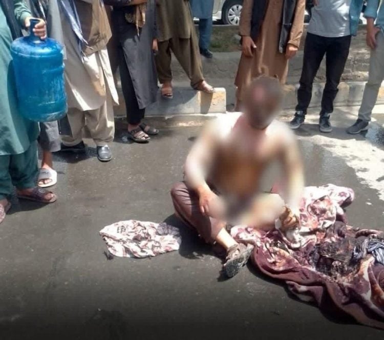 A severely burned man sits on a Kabul street after setting himself on fire amid reports of poverty and unemployment. (Photo credit: Social media)