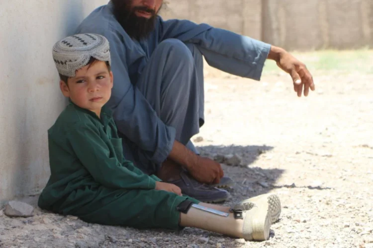 A child with an artificial leg sits beside his father in front of a wall, highlighting the challenges faced by children living with disabilities. (Photo credit: Exclusive)
