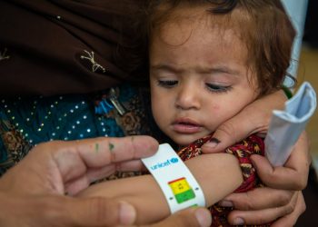 برنامه جهانی غذا: بحران سوءتغذیه در افغانستان تشدید شده است