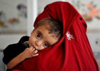 اوچا: ۵.۷ میلیون کودک و مادر در معرض خطر از دست دادن خدمات تغذیه‌ای قرار دارند